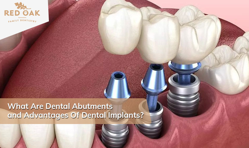 What Are Dental Abutments and Advantages Of Dental Implants