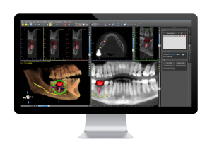 screenshot-01-300x211