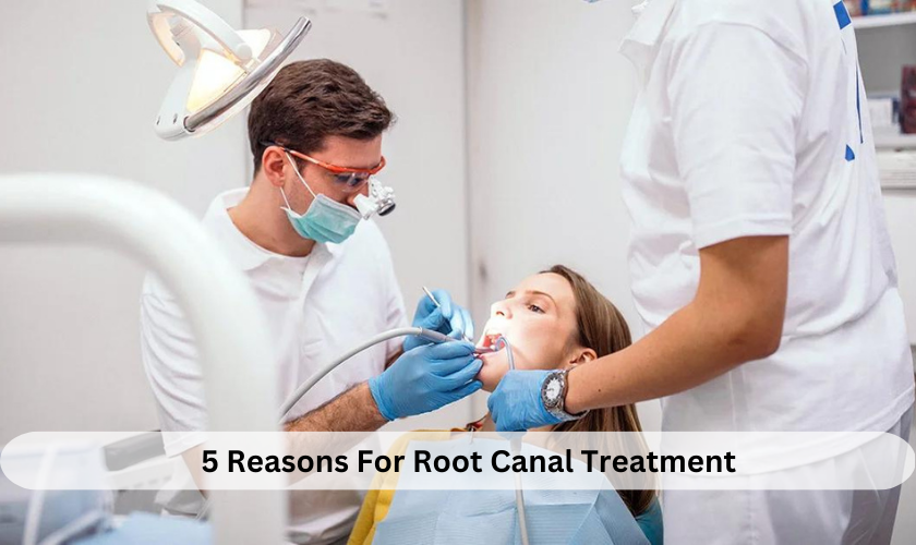 Featured image for “5 Reasons For Root Canal Treatment”