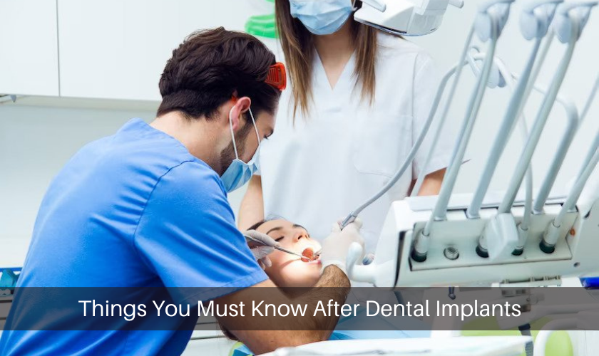 Things You Must Know After Dental Implants
