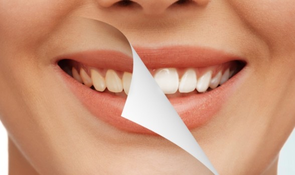 Featured image for “Learn How A Cosmetic Dentist Can Change Your Smile.”