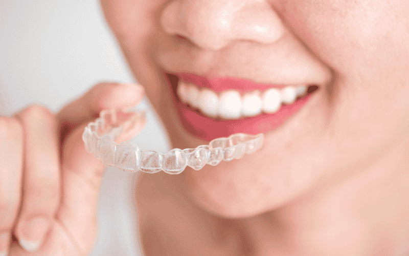 Featured image for “Clear Aligners for Adults: Achieving a Straight Smile Without Metal Braces”