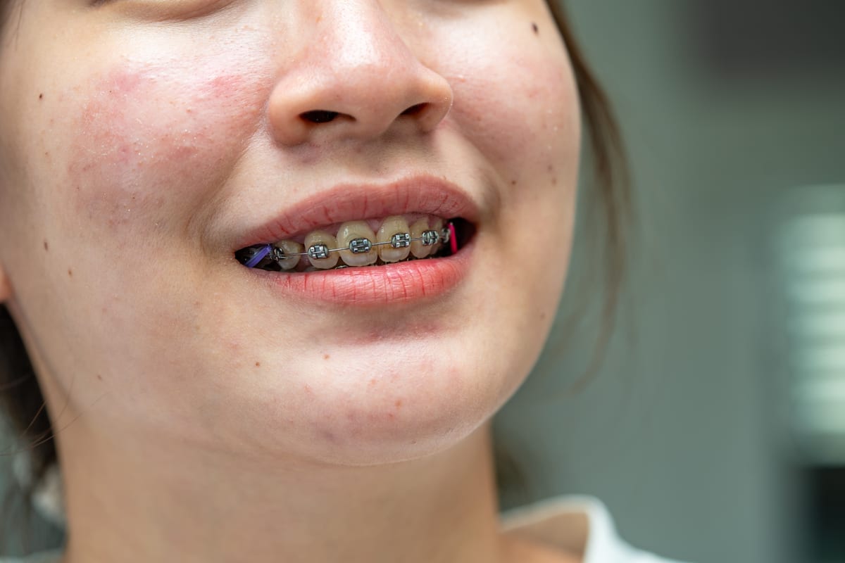 Orthodontics in McKinney